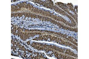 IHC analysis of MCM4 using anti-MCM4 antibody (ABIN7601485). (MCM4 抗体  (AA 361-677))