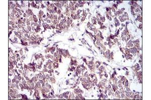 Immunohistochemistry (IHC) image for anti-Protein tyrosine Phosphatase, Non-Receptor Type 1 (PTPN1) (AA 40-246) antibody (ABIN5542667)