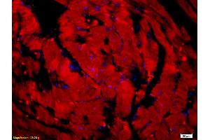 Formalin-fixed and paraffin embedded mouse heart tissue labeled with Anti-LSP1 Polyclonal Antibody, unconjugated (ABIN755632) at 1: 200 followed by incubation with conjugated secondary antibody (Goat Anti-Rabbit IgG, Cy3 conjugated   used at 1: 200 dilution for 40 minutes at 37°C and DAPI staining). (LSP1 抗体  (AA 241-339))