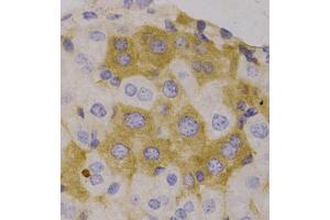 Immunohistochemistry of paraffin-embedded human liver, using NBR1 antibody (ABIN5972123). (NBR1 抗体)