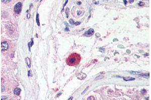 Human Testis, Mast Cell (formalin-fixed, paraffin-embedded) stained with TNFRSF13B antibody ABIN214533 at 5 ug/ml followed by biotinylated goat anti-rabbit IgG secondary antibody ABIN481713, alkaline phosphatase-streptavidin and chromogen.