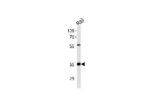 Western blot analysis of lysate from Raji cell line,using ACOT8 Antibody (ABIN6241571). (ACOT8 抗体)