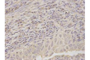 Immunohistochemistry (IHC) image for anti-Ribosomal Protein, Large, P0 (RPLP0) antibody (ABIN1876737) (RPLP0 抗体)