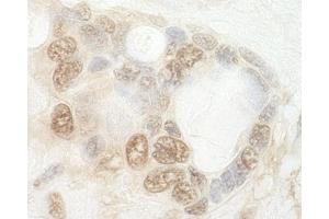 Immunohistochemistry (IHC) image for anti-CCR4-NOT Transcription Complex, Subunit 2 (CNOT2) (AA 490-540) antibody (ABIN7448479) (CNOT2 抗体  (AA 490-540))