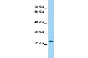 Host: Rabbit Target Name: Nsg1 Sample Type: Rat Testis lysates Antibody Dilution: 1. (NSG1 抗体  (N-Term))