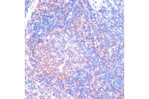 Immunohistochemistry of paraffin-embedded mouse spleen using RPS6K antibody (ABIN7270037) at dilution of 1:100 (40x lens). (RPS6KA2 抗体  (AA 632-733))