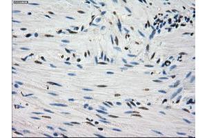 Image no. 5 for anti-Fumarate Hydratase (FH) antibody (ABIN1498267)