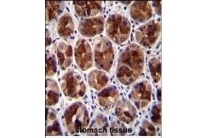 SERTAD4 Antibody (C-term) (ABIN655326 and ABIN2844897) immunohistochemistry analysis in formalin fixed and paraffin embedded human stomach tissue followed by peroxidase conjugation of the secondary antibody and DAB staining. (SERTAD4 抗体  (C-Term))