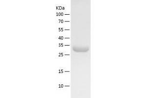Western Blotting (WB) image for Protein Phosphatase 1, Catalytic Subunit, gamma Isoform (PPP1CC) (AA 2-323) protein (His tag) (ABIN7124663)