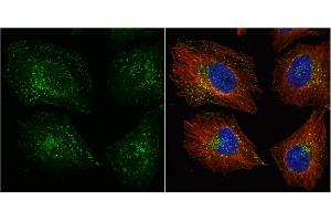 Immunofluorescence (IF) image for anti-Vacuolar Protein Sorting 35 (VPS35) (C-Term) antibody (ABIN2856562)