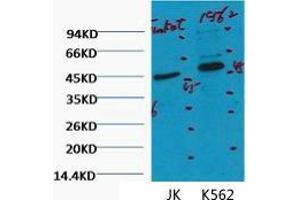 Western Blot (WB) analysis of 1) Jurkat, 2) K562, diluted at 1:2000. (CD16 抗体)