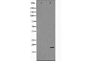 Western blot analysis on HuvEc cell lysate using TP53I11 Antibody. (TP53I11 抗体  (N-Term))