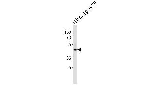 FGG Antibody (C-term) (ABIN391494 and ABIN2841461) western blot analysis in human blood plasma cell line lysates (35 μg/lane). (FGG 抗体  (C-Term))