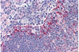 Human Thymus (formalin-fixed, paraffin-embedded) stained with TLR6 antibody ABIN214529 at 5 ug/ml followed by biotinylated goat anti-rabbit IgG secondary antibody ABIN481713, alkaline phosphatase-streptavidin and chromogen. (TLR6 抗体  (Internal Region))
