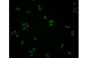 Immunofluorescence staining of Hela cells with ABIN7148805 at 1:100, counter-stained with DAPI. (ATF6 抗体  (AA 1-194))