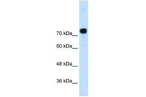 Alpha Actinin 4 antibody used at 0. (alpha Actinin 4 抗体  (N-Term))