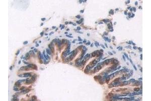 Immunohistochemistry (IHC) image for anti-2',5'-Oligoadenylate Synthetase 1, 40/46kDa (OAS1) (AA 139-358) antibody (ABIN7435082)