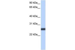 Western Blotting (WB) image for anti-Transmembrane Protease, serine 5 (TMPRSS5) antibody (ABIN2463308) (TMPRSS5 抗体)