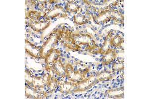 Immunohistochemistry of paraffin-embedded mouse kidney using ZF antibody (ABIN6130814, ABIN6150426, ABIN6150427 and ABIN6223369) at dilution of 1:100 (40x lens). (ZFAND3 抗体  (AA 1-227))