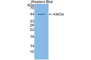 Western Blotting (WB) image for anti-ADAM Metallopeptidase Domain 8 (ADAM8) (AA 145-493) antibody (ABIN1866534)