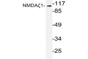 Western blot (WB) analyzes of NMDAzeta1 antibody in extracts from Jurkat cells. (NMDA 1 Receptor 抗体)