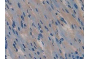 Immunohistochemistry (IHC) image for anti-Spondin 1 (SPON1) (AA 608-802) antibody (ABIN7440035)