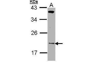 WB Image Sample (30 ug of whole cell lysate) A: Molt-4 , 12% SDS PAGE antibody diluted at 1:1000 (ZNHIT1 抗体)
