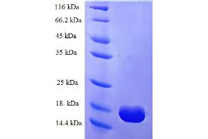SDS-PAGE (SDS) image for Thymocyte Alloantigen (TTHY) (AA 21-147) protein (His tag) (ABIN5710558)