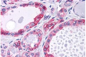 Human Thyroid: Formalin-Fixed, Paraffin-Embedded (FFPE) (CTNNB1 抗体)
