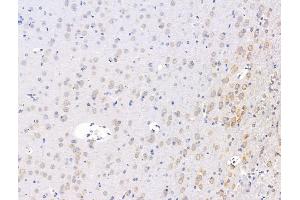 ABIN7094610 and ABIN7098660 at 1/100 staining Rat brain tissue by IHC-P. (FKBP3 抗体  (Internal Region))
