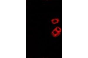Immunofluorescent analysis of Tryptase alpha/beta staining in Hela cells. (TPSAB1 抗体)