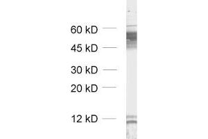 dilution: 1 : 1000, sample: unboiled synaptic membrane fraction of rat brain (LP1) (GABRB2 抗体  (AA 343-430))