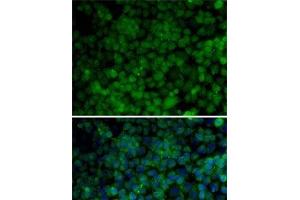 Immunofluorescence analysis of HeLa cells using CDK7 Polyclonal Antibody (CDK7 抗体)