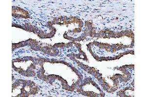 IHC analysis of HSD17B7 using anti-HSD17B7 antibody (ABIN7600174).