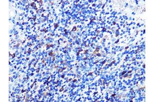 Immunohistochemistry of paraffin-embedded human appendix using Stathmin 1 Rabbit mAb (ABIN1678518, ABIN3018873, ABIN3018874 and ABIN7101680) at dilution of 1:100 (40x lens). (Stathmin 1 抗体)