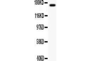 Anti-MEKK1 antibody, Western blotting All lanes: Anti MEKK1  at 0.