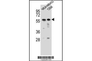 Western blot analysis in MDA-MB453,CEM cell line lysates (35ug/lane). (FOXD4 抗体  (AA 182-210))