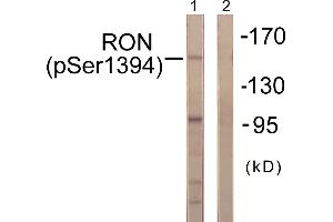 Western blot analysis of extracts from HeLa cells, treated with TNF-a (20ng/ml, 2mins), using CD136/RON (Phospho-Ser1394) antibody. (MST1R 抗体  (pSer1394))