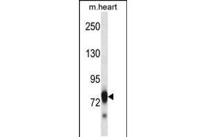 Western blot analysis in mouse heart tissue lysates (35ug/lane). (SCYL3 抗体  (C-Term))