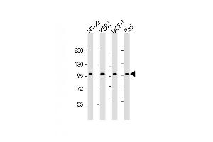 All lanes : Anti-TPX2 Antibody at 1:2000 dilution Lane 1: HT-29 whole cell lysate Lane 2: K562 whole cell lysate Lane 3: MCF-7 whole cell lysate Lane 4: Raji whole cell lysate Lysates/proteins at 20 μg per lane. (TPX2 抗体  (AA 1-531))