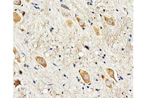 IHC-P: Dopamine Receptor D3 antibody testing of rat brain tissue (DRD3 抗体  (C-Term))