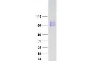 Validation with Western Blot
