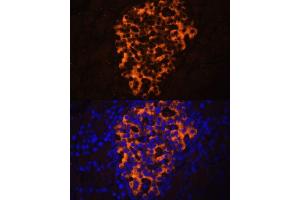 Immunofluorescence analysis of rat pancreas using PNLIPRP2 antibody (ABIN6130643, ABIN6145842, ABIN6145843 and ABIN6216695) at dilution of 1:100. (PNLIPRP2 抗体  (AA 301-470))