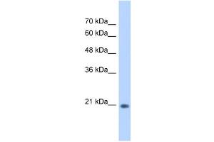 WB Suggested Anti-GINS2 Antibody Titration:  0. (GINS2 抗体  (C-Term))