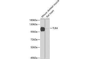 Western blot analysis of extracts of various cell lines, using TLR4 antibody (ABIN6134488, ABIN6149222, ABIN6149225 and ABIN6215119) at 1:1000 dilution. (TLR4 抗体  (AA 500-600))