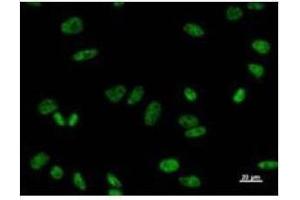 Immunostaining analysis in HeLa cells. (PRPF8 抗体)