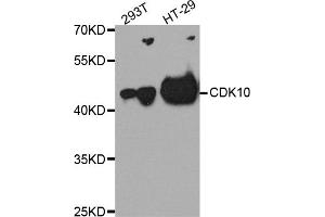 Western blot analysis of extracts of various cell lines, using CDK10 antibody (ABIN5975358) at 1/1000 dilution. (CDK10 抗体)