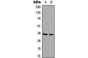 Western blot analysis of B3GALT6 expression in HeLa (A), PC12 (B) whole cell lysates. (B3GALT6 抗体  (Center))