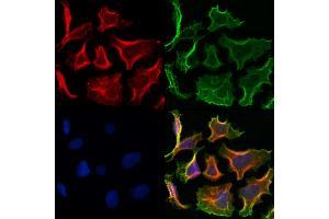 ABIN6260811 and ABIN6272991 staining Hela cells by IF/ICC.