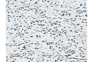 IHC analysis of ARL6IP6 using anti-ARL6IP6 antibody (ABIN7603020). (ARL6IP6 抗体  (Middle Region))